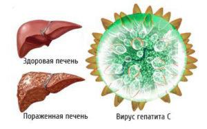 Pechen' i virus gepatita C